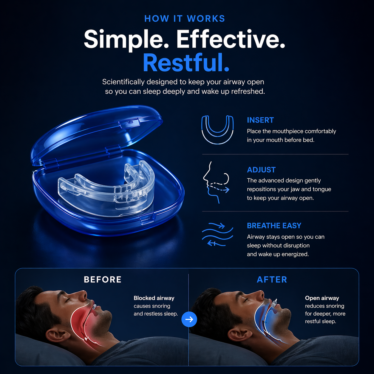 Anti-Snore Mouthpiece